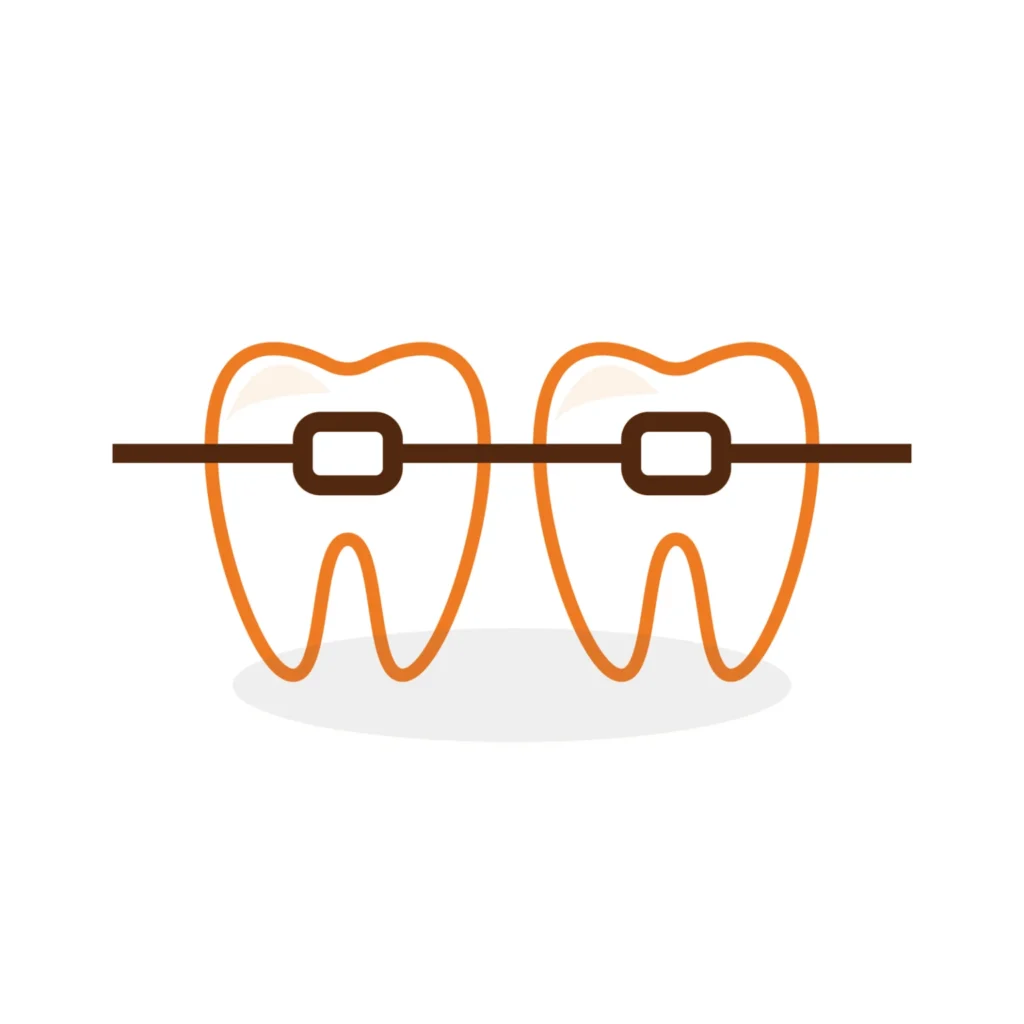 dental braces